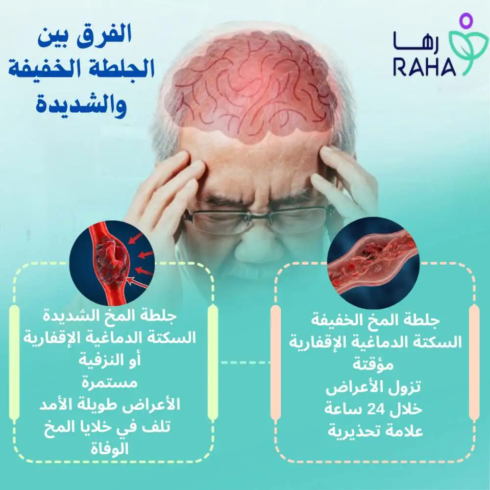 الفرق بين الجلطة الخفيفة والشديدة